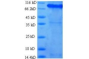 SDS-PAGE (SDS) image for Integrin beta 1 (ITGB1) (AA 21-729) protein (His tag) (ABIN1474694)