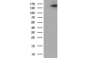 Western Blotting (WB) image for anti-L1 Cell Adhesion Molecule (L1CAM) antibody (ABIN1499087) (L1CAM Antikörper)