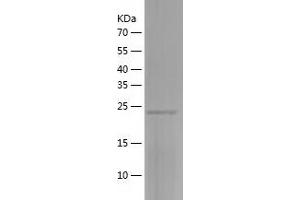 ZC4H2 Protein (AA 1-224) (His tag)