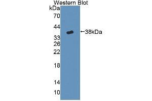 Detection of Recombinant CYP17A1, Mouse using Polyclonal Antibody to Cytochrome P450 17A1 (CYP17A1) (CYP17A1 Antikörper  (AA 201-507))