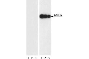 Western blot analysis of PLK1 (pT210) in transformed human epithelioid carcinoma.