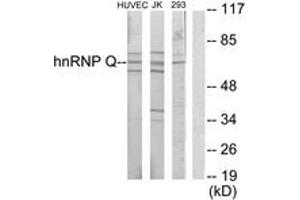 Western Blotting (WB) image for anti-Synaptotagmin Binding, Cytoplasmic RNA Interacting Protein (SYNCRIP) (AA 236-285) antibody (ABIN1533522)