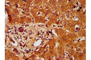 IHC image of ABIN7164887 diluted at 1:200 and staining in paraffin-embedded human liver tissue performed on a Leica BondTM system. (PTOV1 Antikörper  (AA 2-137))