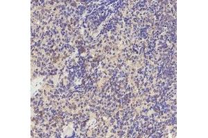 Immunohistochemistry (IHC) image for anti-Transforming Growth Factor, beta Receptor 1 (TGFBR1) (pSer165) antibody (ABIN7193143)