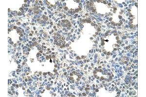 SLC26A5 antibody was used for immunohistochemistry at a concentration of 4-8 ug/ml.