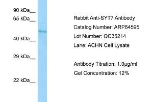 Western Blotting (WB) image for anti-Synaptotagmin VII (SYT7) (C-Term) antibody (ABIN2789889) (SYT7 Antikörper  (C-Term))