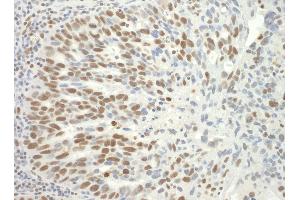 anti-Splicing Factor 3b, Subunit 3, 130kDa (SF3B3) (AA 1167-1217) antibody
