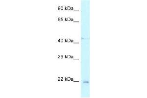 Western Blot showing Twist1 antibody used at a concentration of 1. (TWIST1 Antikörper  (N-Term))