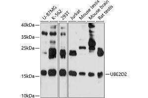 Western blot analysis of extracts of various cell lines, using UBE2D2 antibody (ABIN6130768, ABIN6149789, ABIN6149790 and ABIN6214999) at 1:1000 dilution. (UBE2D2 Antikörper  (AA 1-147))