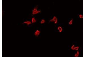 Immunofluorescence (fixed cells) (IF/ICC) image for anti-Spleen tyrosine Kinase (SYK) (pTyr323) antibody (ABIN6256708)