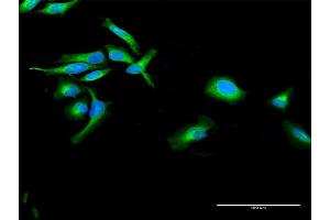 Immunofluorescence of purified MaxPab antibody to POR on HeLa cell. (POR Antikörper  (AA 1-680))