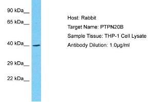 Host: Rabbit Target Name: PTPN20B Sample Type: THP-1 Whole Cell lysates Antibody Dilution: 1. (PTPN20 Antikörper  (N-Term))