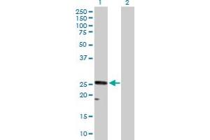 Western Blot analysis of CACNG1 expression in transfected 293T cell line by CACNG1 MaxPab polyclonal antibody. (CACNG1 Antikörper  (AA 1-222))