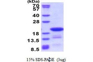 Chromosome 14 Open Reading Frame 126 (C14orf126) (AA 1-168) protein (His tag)
