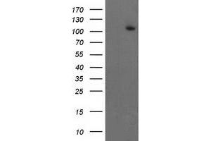 Western Blotting (WB) image for anti-Excision Repair Cross-Complementing Rodent Repair Deficiency, Complementation Group 4 (ERCC4) antibody (ABIN1498072) (ERCC4 Antikörper)
