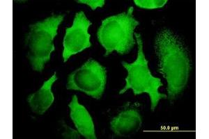 Image no. 3 for anti-PCNA Clamp Associated Factor (PAF) (AA 1-112) antibody (ABIN599096) (KIAA0101 Antikörper  (AA 1-112))