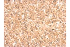 Immunohistochemistry (IHC) image for anti-Filamin B, beta (FLNB) (N-Term) antibody (ABIN2854971)