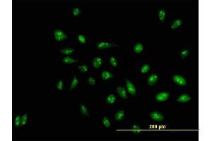Immunofluorescence of purified MaxPab antibody to D21S2056E on HeLa cell. (RRP1 Antikörper  (AA 1-461))