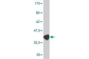 Western Blot detection against Immunogen (38. (CXCL5 Antikörper  (AA 1-114))