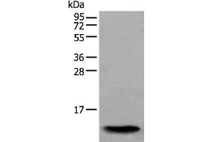 Western blot analysis of Human normal stomach tissue lysate using SAA4 Polyclonal Antibody at dilution of 1:350 (SAA4 Antikörper)