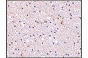 Immunohistochemistry of Nicastrin in human brain tissue with this product at 2. (Nicastrin Antikörper  (Center))