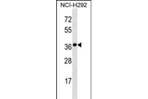 SYNPR Antibody (C-term) (ABIN1536817 and ABIN2850294) western blot analysis in NCI- cell line lysates (35 μg/lane). (Synaptoporin Antikörper  (C-Term))