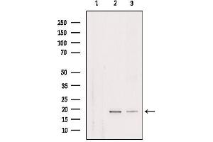 Western blot analysis of extracts from various samples, using RPL29 Antibody. (RPL29 Antikörper  (Internal Region))