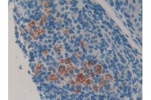 Immunohistochemistry (IHC) image for anti-Lipocalin 8 (LCN8) (AA 27-176) antibody (ABIN7443596)