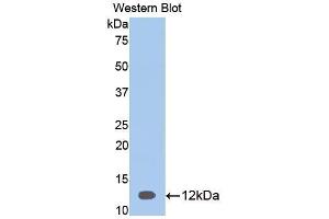Western blot analysis of the recombinant protein. (SERPINA12 Antikörper  (AA 52-143))