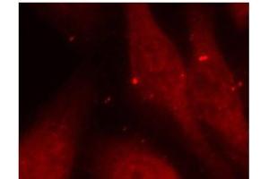 Immunofluorescence analysis of methanol-fixed HeLa cells using Phospho-ABL1(Y412) Polyclonal Antibody (ABL1 Antikörper  (pTyr412))