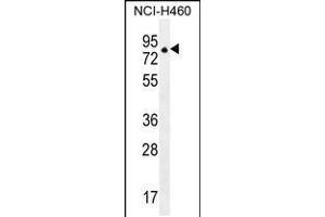 Western blot analysis in NCI-H460 cell line lysates (35ug/lane). (ZFP28 Antikörper  (N-Term))