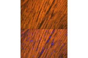 Immunofluorescence analysis of rat heart using  Rabbit mAb (ABIN7265397) at dilution of 1:100 (40x lens). (ACTN2 Antikörper)