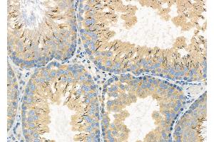 ABIN6261581 and ABIN6272294 at 1/100 staining Rat testis tissue by IHC-P. (EPS8-Like 3 Antikörper  (Internal Region))