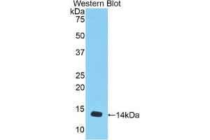 Western blot analysis of the recombinant protein. (MSTN Antikörper  (AA 268-376))