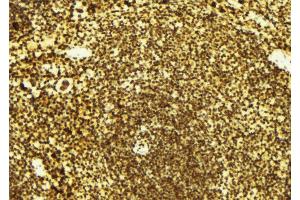 ABIN6274973 at 1/100 staining Mouse spleen tissue by IHC-P. (CTDSP1 Antikörper  (N-Term))