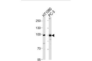 Western Blotting (WB) image for anti-Zinc Finger Protein 560 (ZNF560) antibody (ABIN3004763) (ZNF560 Antikörper)