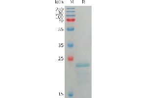 Human Protein, His Tag on SDS-PAGE under reducing condition.
