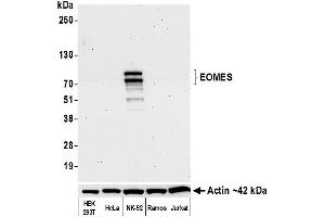 anti-Eomesodermin (EOMES) (AA 125-175) antibody