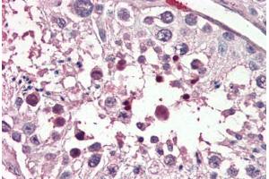 Human Testis (formalin-fixed, paraffin-embedded) stained with PIAS2 antibody ABIN461934 at 3. (PIAS2 Antikörper  (AA 431-445))