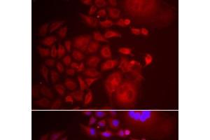 Immunofluorescence analysis of U2OS cells using TRAPPC10 Polyclonal Antibody (TRAPPC10 Antikörper)