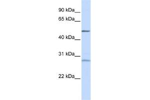 WB Suggested Anti-ZNF141 Antibody Titration:  0. (ZNF141 Antikörper  (N-Term))