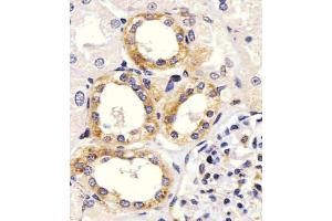 staining EGF in Human kidney tissue sections by Immunohistochemistry (IHC-P - paraformaldehyde-fixed, paraffin-embedded sections). (EGF Antikörper  (Center))
