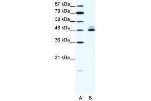 CHRNB2 antibody (20R-1324) used at 2. (CHRNB2 Antikörper  (N-Term))
