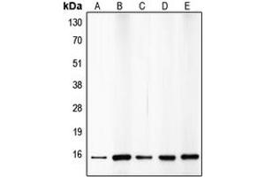 Western blot analysis of p15 INK4b expression in HepG2 (A), A549 (B), HeLa (C), mouse brain (D), rat kidney (E) whole cell lysates. (CDKN2B Antikörper  (C-Term))