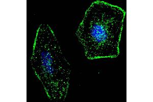 Fluorescent confocal image of SY5Y cells stained with ERAS (F66) antibody.