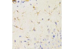 Immunohistochemistry of paraffin-embedded rat brain using KIF1B Antibody (ABIN2563552) at dilution of 1:100 (40x lens). (KIF1B Antikörper)