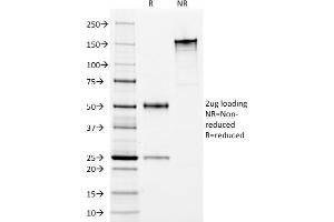 SDS-PAGE Analysis Purified HLA-DP/DR Mouse Monoclonal Antibody (Bra-14). (HLA-DPB1 & HLA-DRA Antikörper)
