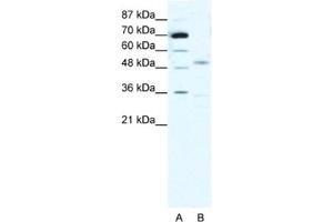 Western Blotting (WB) image for anti-Cholinergic Receptor, Nicotinic, alpha 3 (Neuronal) (CHRNA3) antibody (ABIN2463738) (CHRNA3 Antikörper)