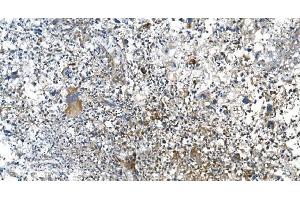 IHC analysis of DRP1/DNM1L using anti-DRP1/DNM1L antibody (ABIN7602180). (Dynamin 1-Like Antikörper  (AA 618-736))