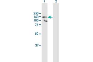Western Blot analysis of HDAC9 expression in transfected 293T cell line by HDAC9 MaxPab polyclonal antibody. (HDAC9 Antikörper  (AA 1-1069))